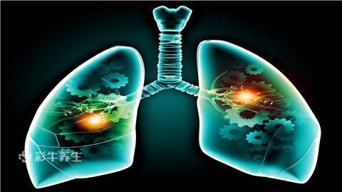 探索矽肺治疗新方法，最新探索与创新实践